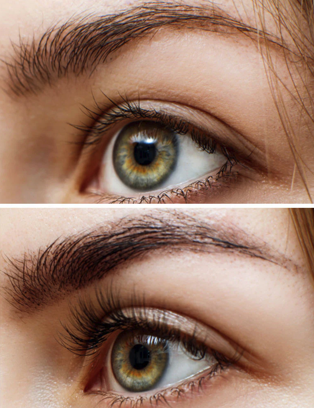 eyes-before-after