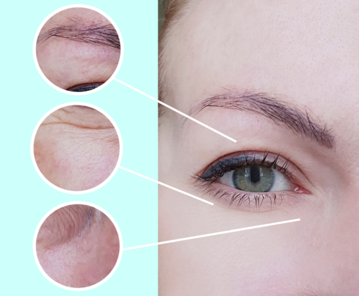 Causes of Aging Around the Eyes