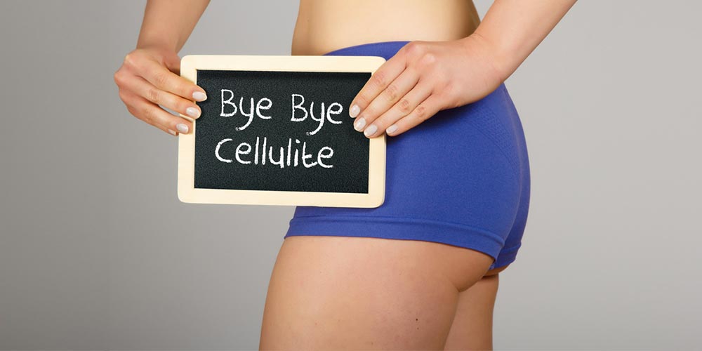 Cellulite