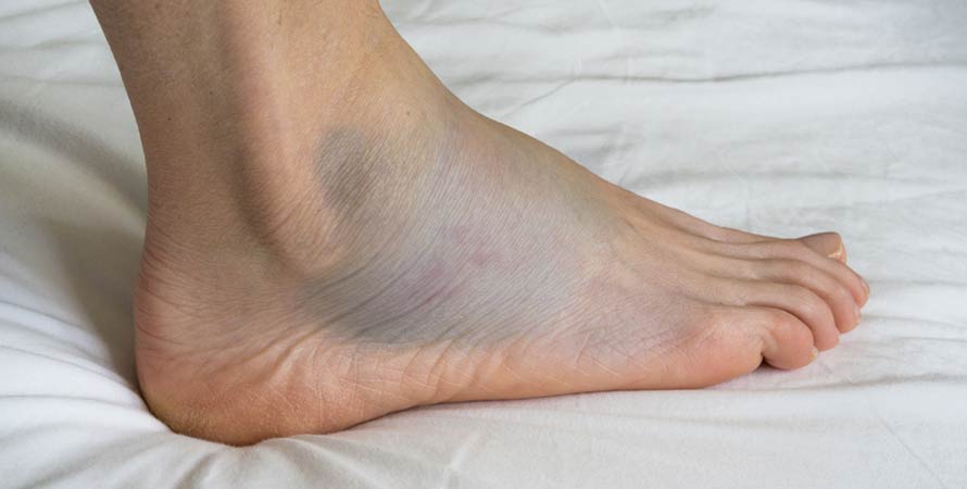Popular Ankle Pain Symptoms