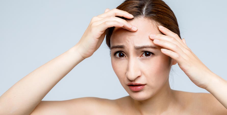 Treatments for forehead acne