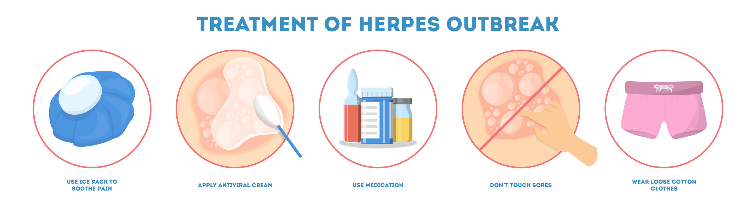 Genital Herpes