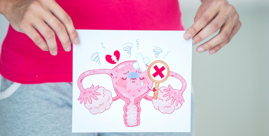 Types of cervical cancer