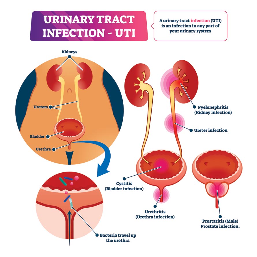 Causes Of Frequent Urination