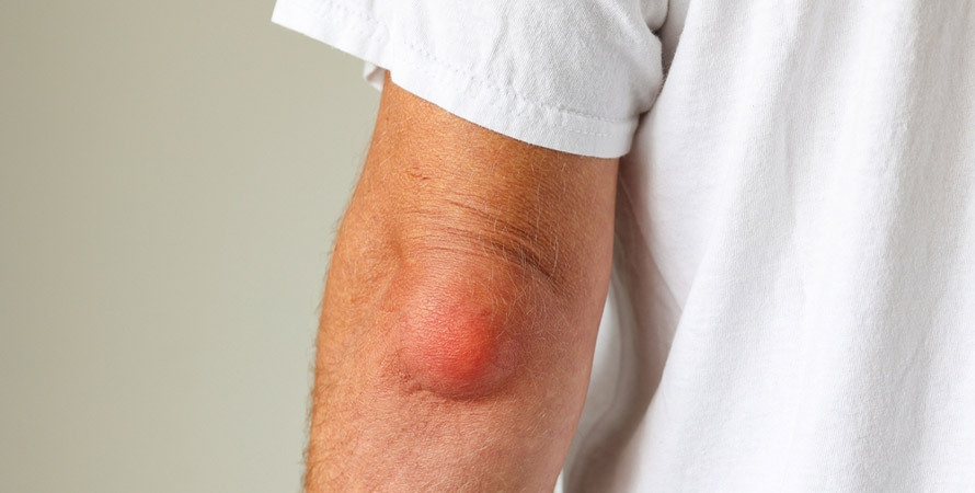 what causes joint pain