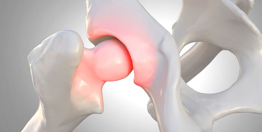 What Can I Give My Dog for Joint Pain at Home – Dog Joint Pain Image