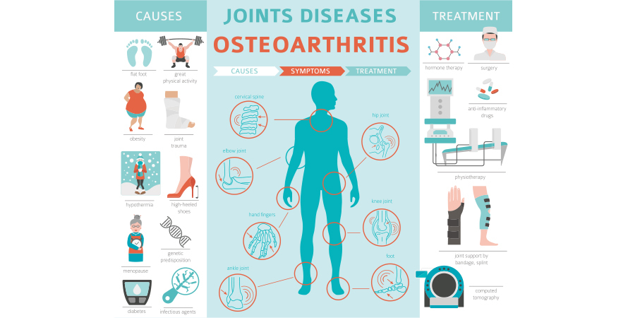can stress cause joint pain &ndash; osteoarthritis and inflammation