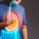 Everything You Need to Know About Acid Reflux and GERD