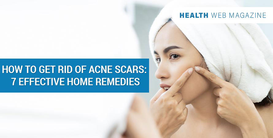 Acne Scars Home Remedies