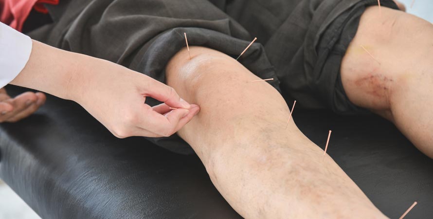 knee pain treatment option is acupuncture