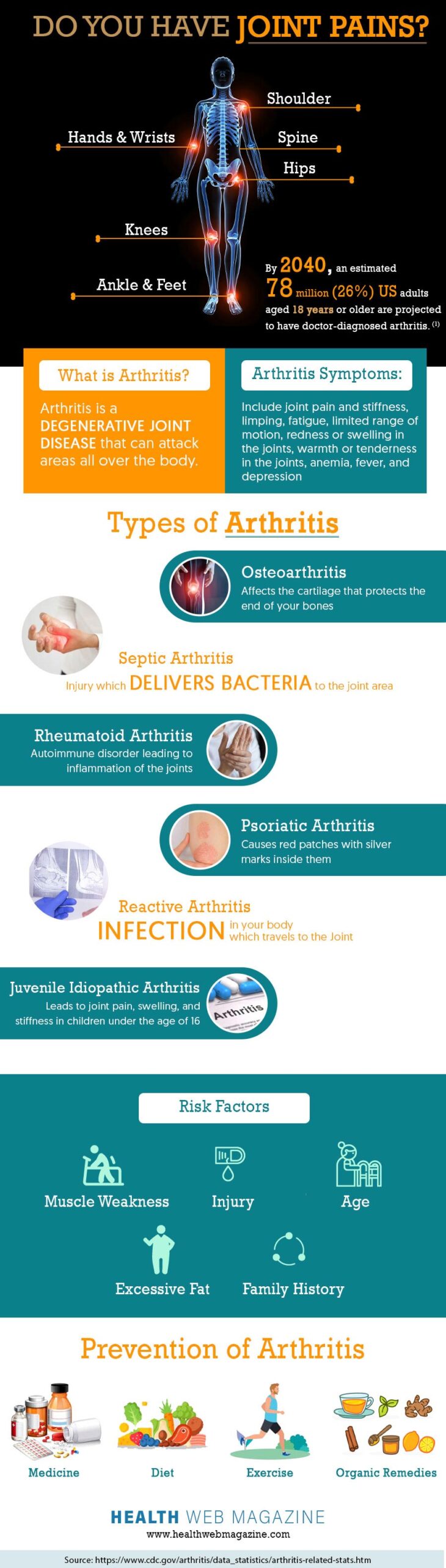 Arthritis Types and Prevention info