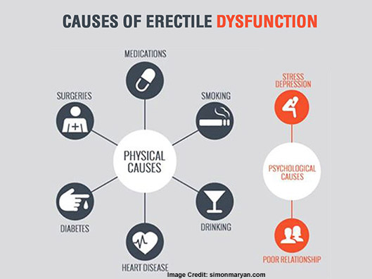 Causes of erectile dysfunction