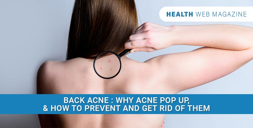 Get Rid Of Back Acne