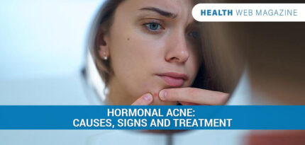 Hormonal Acne