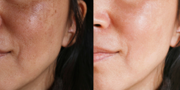 Juvabrite Really Lighten the Skin