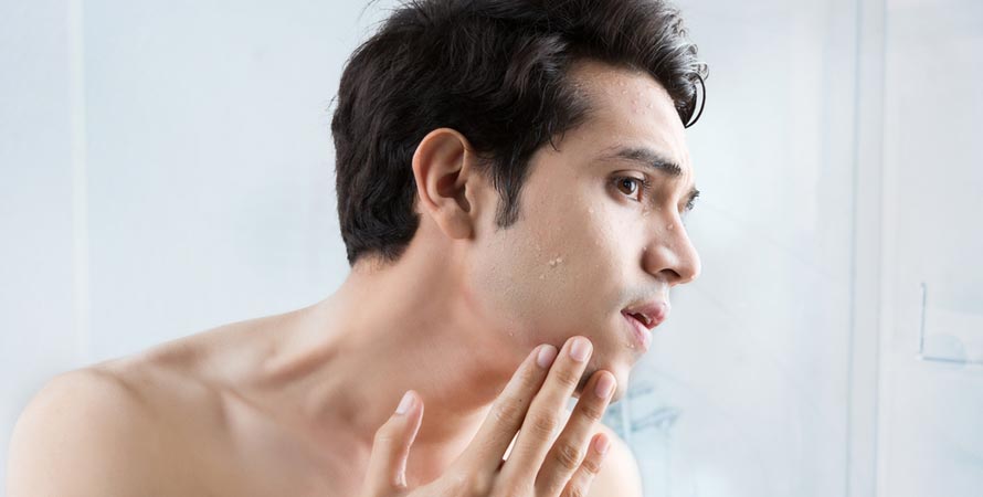 Know Your Skin Type