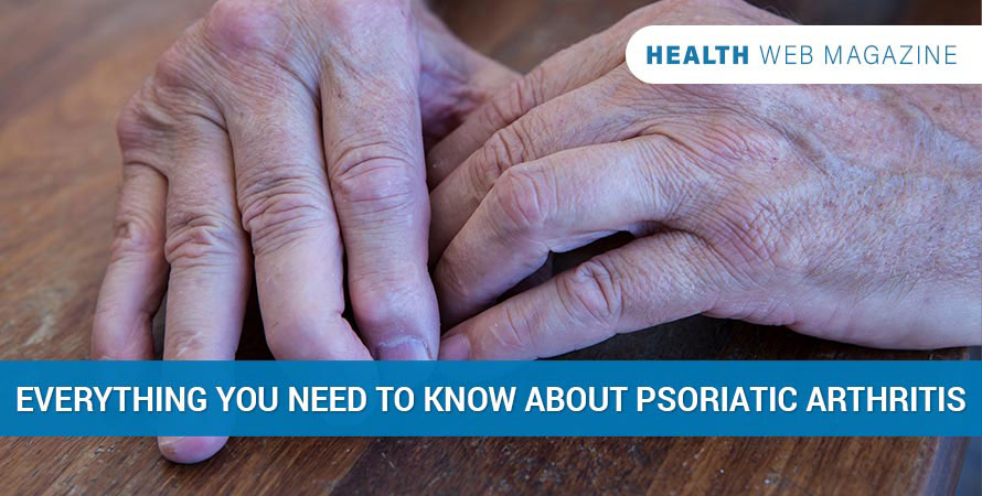 Psoriatic Arthritis