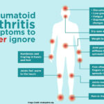 Rheumatoid Arthritis Diet: Inflammation-Fighting Foods