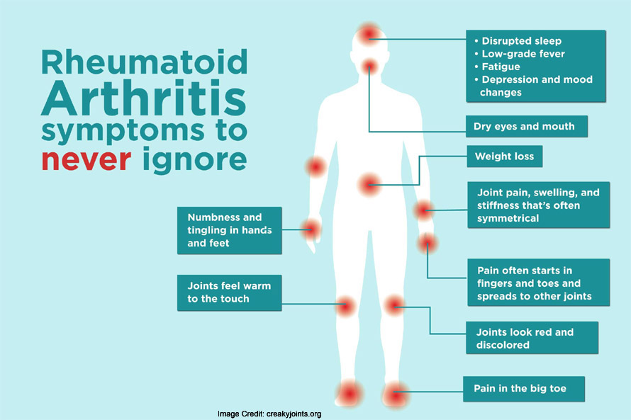 Symptoms of rheumatoid arthritis