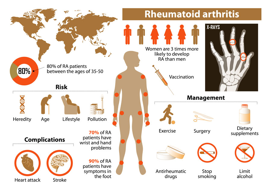 signs-of-rheumatoid-arthritis